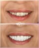 Slider image (10) Perla Dental Centre